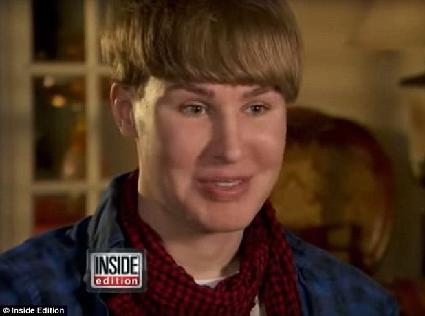 Photo of Justin Bieber Fan Who Spent $100,00 On Surgery To Look Like Him Is Missing