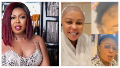 Photo of Afia Schwarzenegger Opens Up About Her Hair Transplant And Other Surgeries In Turkey